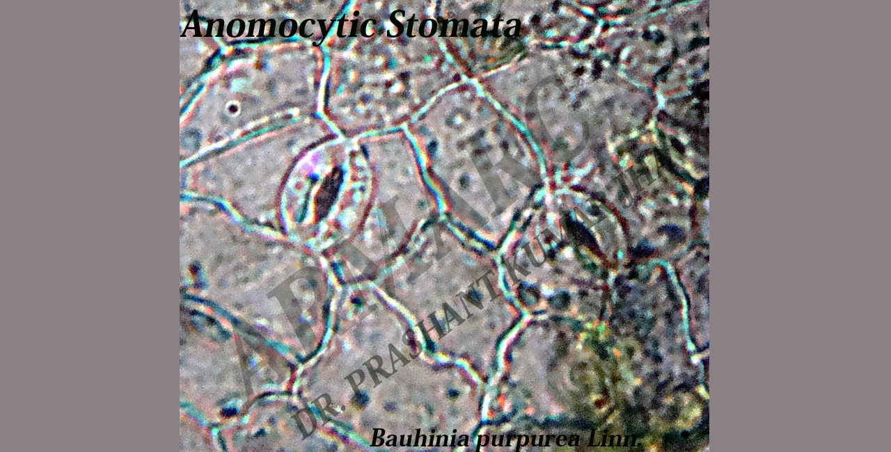 Anomocytic stomata of Bauhinia purpurea Linn.