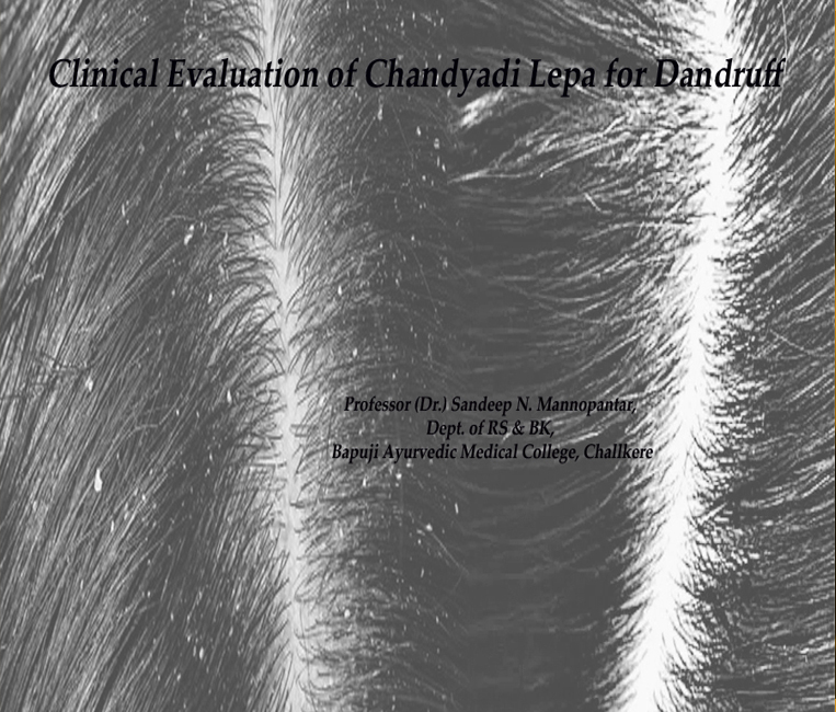 Clinical Evaluation of Chandyadi Lepa for Dandruff