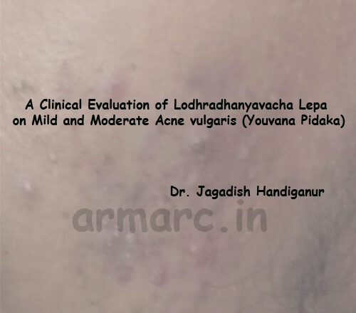 A Clinical Evaluation of Lodhradhanyvacha Lepa on Mild and Moderate Acne vulgaris (Youvana Pidaka)